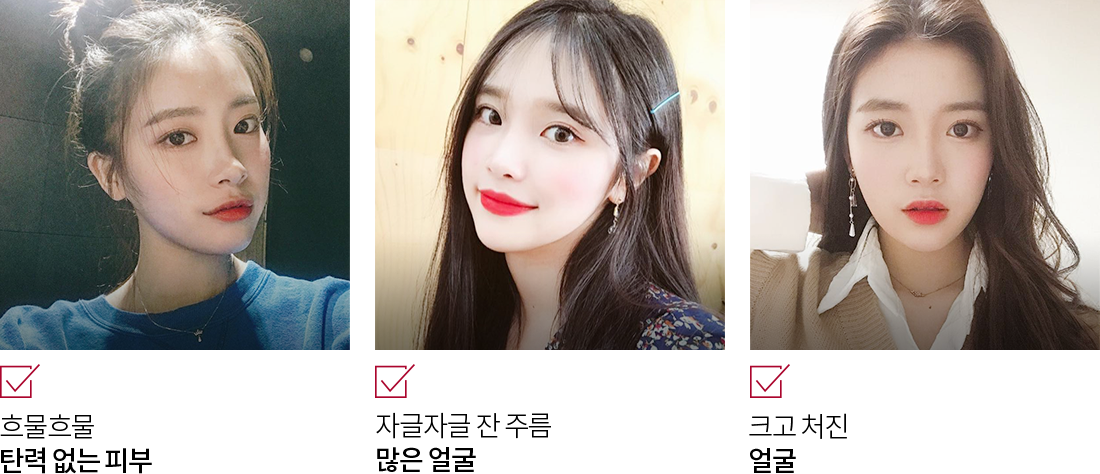 흐물흐물 탄력 없는 피부